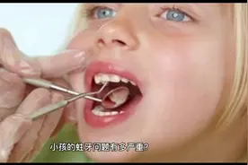 发现孩子蛀牙一定要尽早治疗，不要再拖啦。否则可能影响孩子一生视频封面