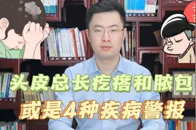 头皮里老是长疙瘩和脓包，是怎么回事？有可能是这4种疾病惹的祸视频封面