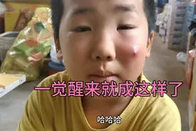 脸上长痘痘 本来是个红点 睡醒一觉怎么成这样了视频封面