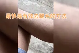 叫你最快最有效祛腿毛的方法