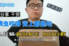 小伙被螨虫咬得背上都是坨 困扰多年 看他如何自救 除螨经验分享视频封面