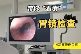带你看第一视野⊙ω⊙了解胃镜检查过程视频封面