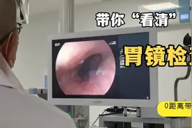 带你看第一视野⊙ω⊙了解胃镜检查过程视频封面