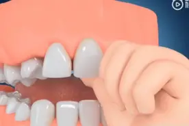 小孩吸手指的危害了解一下😲视频封面