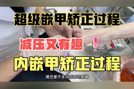 解压又有趣，内嵌指甲该怎么矫正，一起来看看视频封面