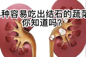 夏天是肾结石的高发期，4种容易吃出结石的蔬菜，我们应尽量少吃视频封面