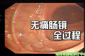 无痛肠镜全过程，真的没有那么可怕！视频封面