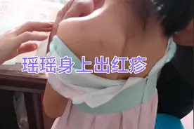 瑶瑶半夜身上奇痒抓个不停，带去看医生，结果却是因为这个视频封面