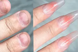 美甲纠正｜如何拯救宽短丑的短指甲？【肉包甲】