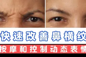 超过50岁出现鼻横纹别担心，两个方法教你改善