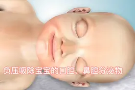 负压吸引器吸除宝宝口腔分泌物，我觉得手动的更好！视频封面