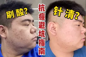 痘肌必看！针清初体验，管用还是坑？祛痘机构里的猫腻当众揭穿！视频封面