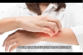 为什么有的人怕痒，有的人又不怕呢？视频封面