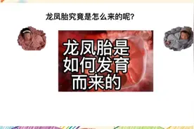 龙凤胎是如何发育而来的，它和双胞胎的区别又在哪里呢？视频封面