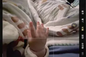 这小肉手谁看谁不迷糊呀，从纤纤玉手→肉肉猪蹄的改变视频封面