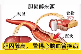 胆固醇升高， 会引起心脑血管疾病，危及到我们的身体健康！