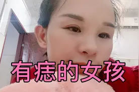 从小因为嘴角的痣很自卑，但是你们却告诉我说这是好痣，我看开了视频封面