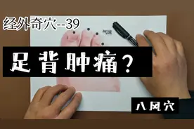经外奇穴--足背肿痛，试试八风穴。视频封面