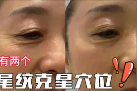 眼尾有两个抗老穴，睡前按摩100下，鱼尾纹慢慢消失视频封面