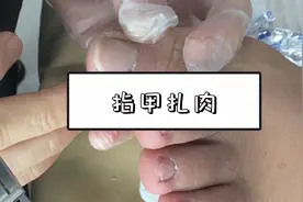 指甲扎肉，有点发炎了。视频封面