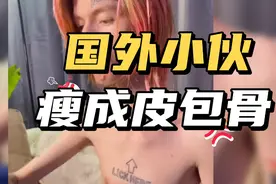 国外小伙天天吃薯条汉堡，结果却瘦成了皮包骨视频封面