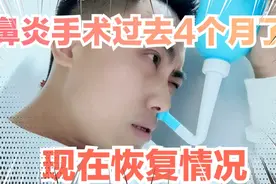 鼻炎手术鼻甲肥大，术后4个月恢复情况，终于摆脱了烦恼视频封面