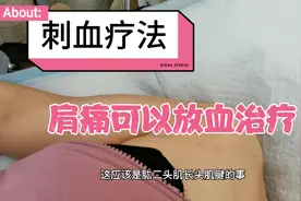 肩膀痛可以试一下放血治疗，舒筋活血止痛，放完就感觉轻快视频封面