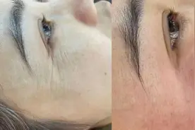 眼部有一个“鱼尾纹开关”按摩3分钟梳通100下，和眼尾纹说拜拜