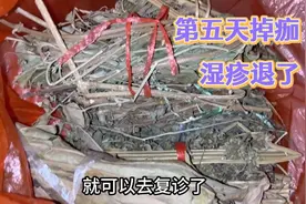 第五天完全掉完痂：脚上湿疹已经平掉像蛇皮一样粗糙用祛湿汤排毒视频封面