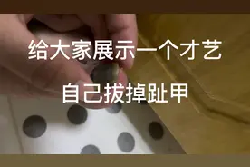 拔掉脚趾甲的酸爽 你体验过吗视频封面
