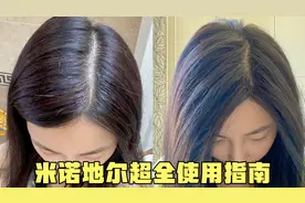 米诺地尔超全使用指南 用之前看这一篇就够了