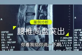 腰胯疼，腿痛，两个节段腰椎间盘突出，保守治疗效果不好，咋办？视频封面