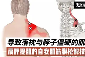 自我肌筋膜松解技术之导致落枕与脖子僵硬的肌肉，肩胛提肌视频封面