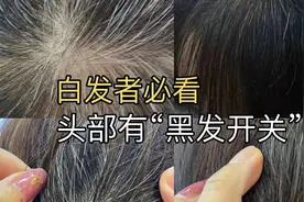 头部有一个“黑发开关”每天梳通50下按摩50下，快速白转黑视频封面