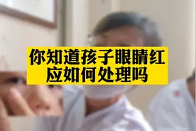 你知道孩子眼睛红应如何处理吗？视频封面