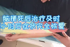 脑梗后不能说话、不能动，就因为治疗及时，只用一小时就恢复正常视频封面