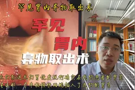 罕见胃内异物枣核内镜下取出术，细嚼慢咽，拒绝囫囵吞枣！视频封面