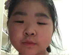 猜一猜我是单眼皮还是双眼皮。