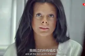 纪录片《韩国 - 整容之都》视频封面