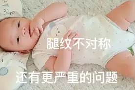 6个月宝宝腿纹不对称 却检查出更严重的问题 崩溃视频封面