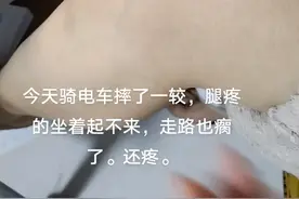 骑电车摔跤了，腿疼的走不成路了视频封面