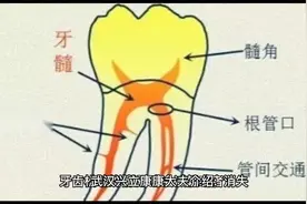 牙齿松动疼痛怎么办？视频封面