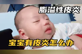 47天宝宝头顶结了很多痂，怀疑是脂溢性皮炎，涂茶籽油真的有用吗视频封面