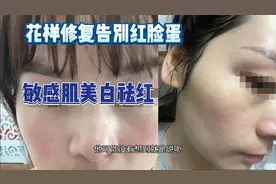 分享提取祛斑后退反黑，修复红脸蛋反复红小妙招！告别红脸蛋！视频封面
