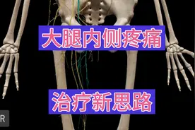 大腿内侧疼痛，久治不愈的考虑一下闭孔神经卡压！视频封面