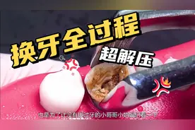 慎入！舒服又解压的坏牙换牙全过程~视频封面