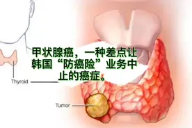 甲状腺癌，一种差点让韩国“防癌险”业务中止的癌症。视频封面