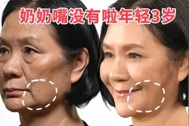 2个动作奶奶嘴没有了，整个人年轻3-5岁，阿姨变姐姐