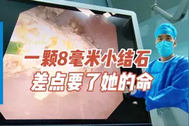 一颗8毫米小结石，差点要了他的命。输尿管结石导致感染性休克。视频封面