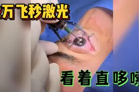 小哥2万块做激光手术，过程看着眼睛疼，直哆嗦，近视真难受视频封面